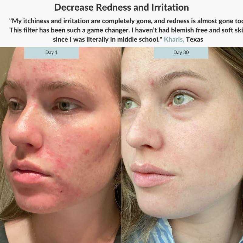 Advanced Water Filter With PRODermis